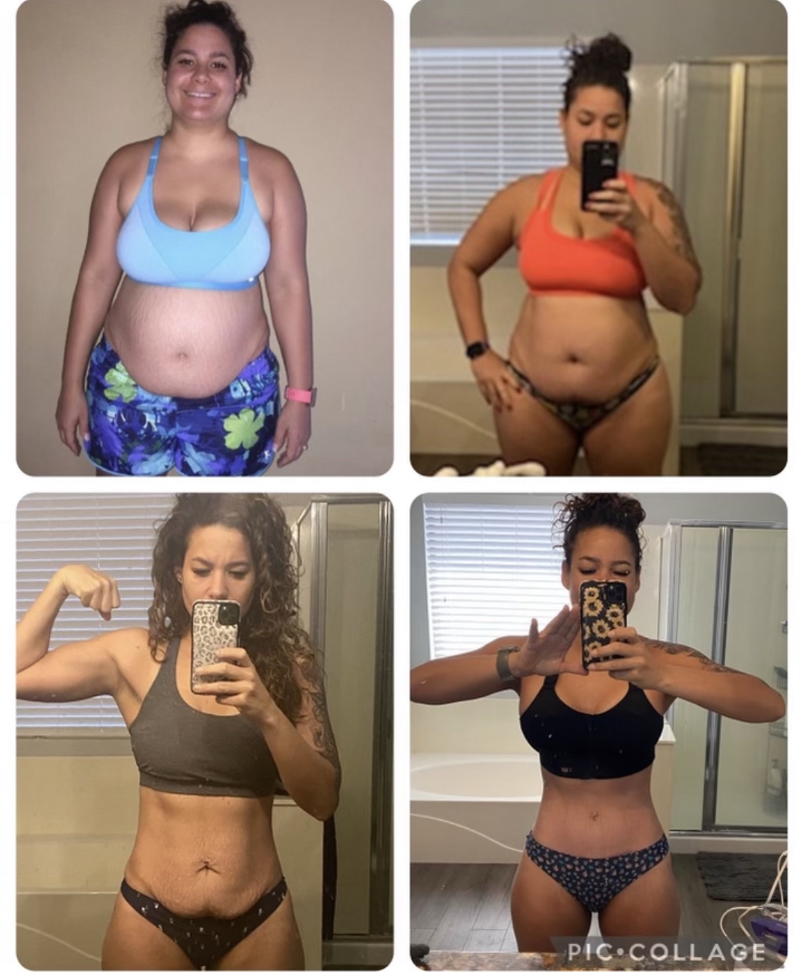 Patient-created mommy makeover progression collage 1, showing the patient in comparisons 5 and 6 over time
