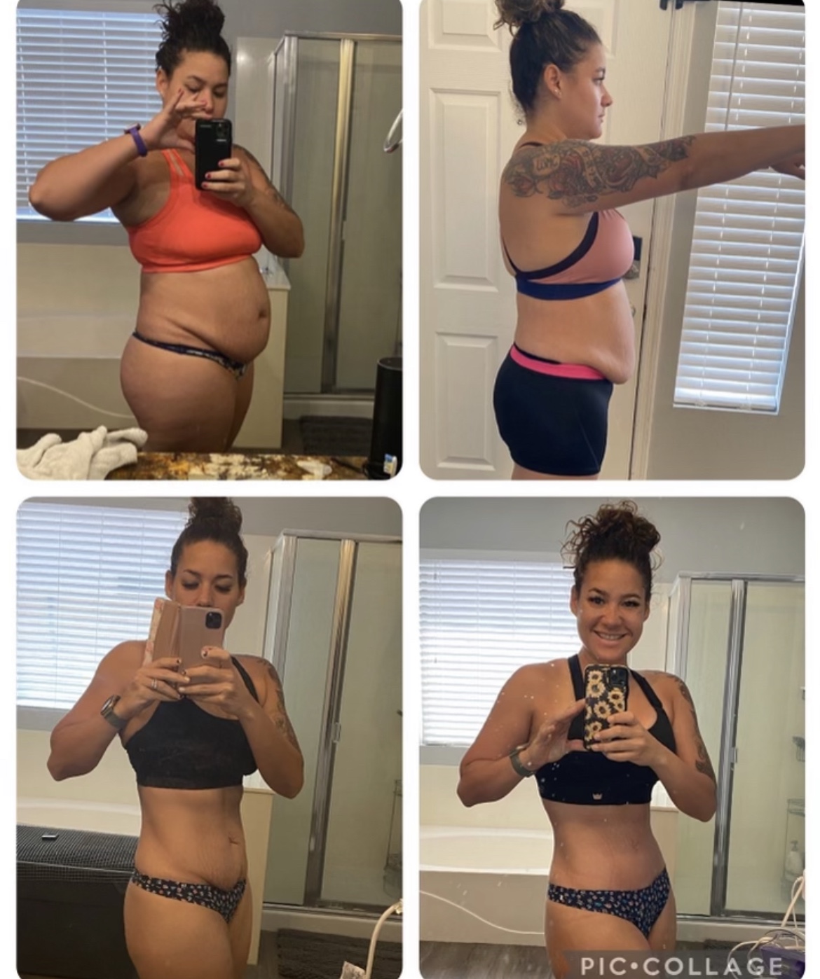 Patient-created mommy makeover progression collage 2, showing the patient in comparisons 5 and 6 over time