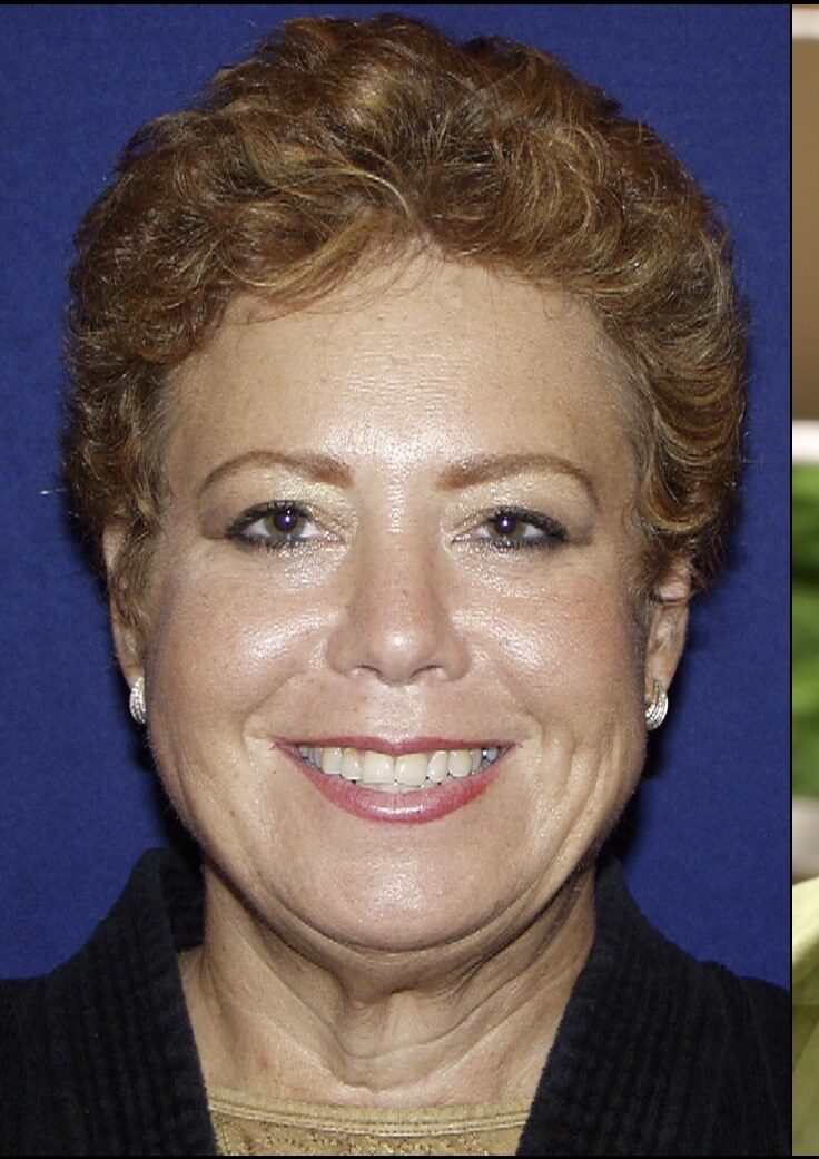 Before 4D facelift front view photograph, West Palm Beach area patient