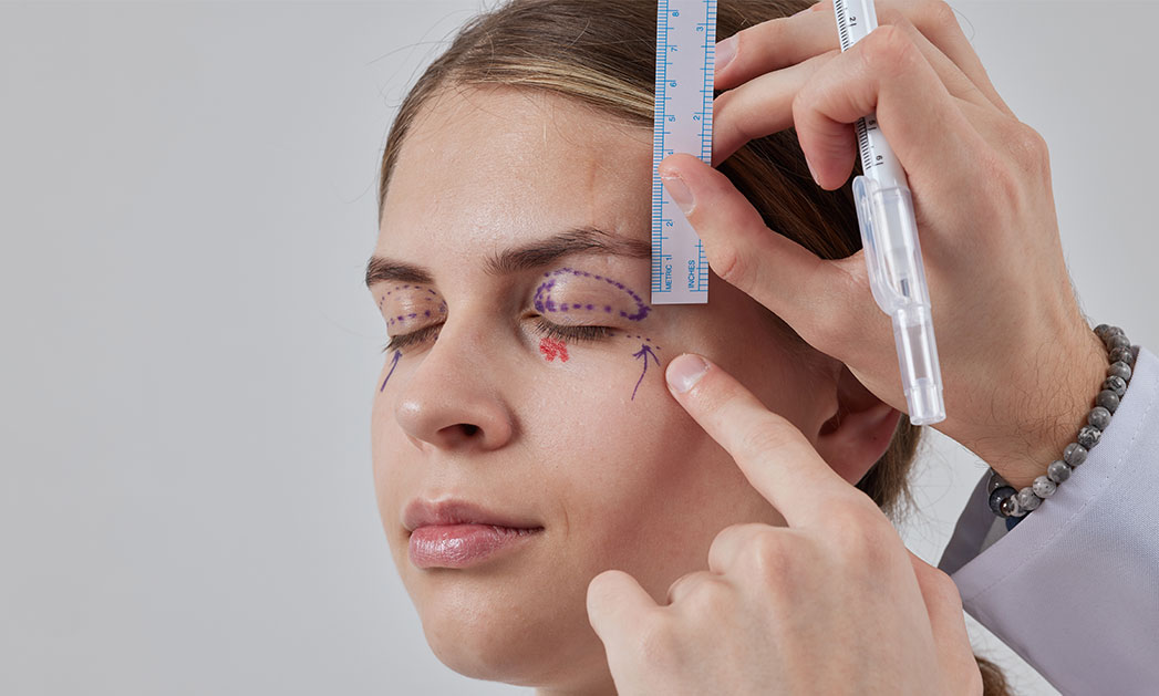 Blepharoplasty Consultation