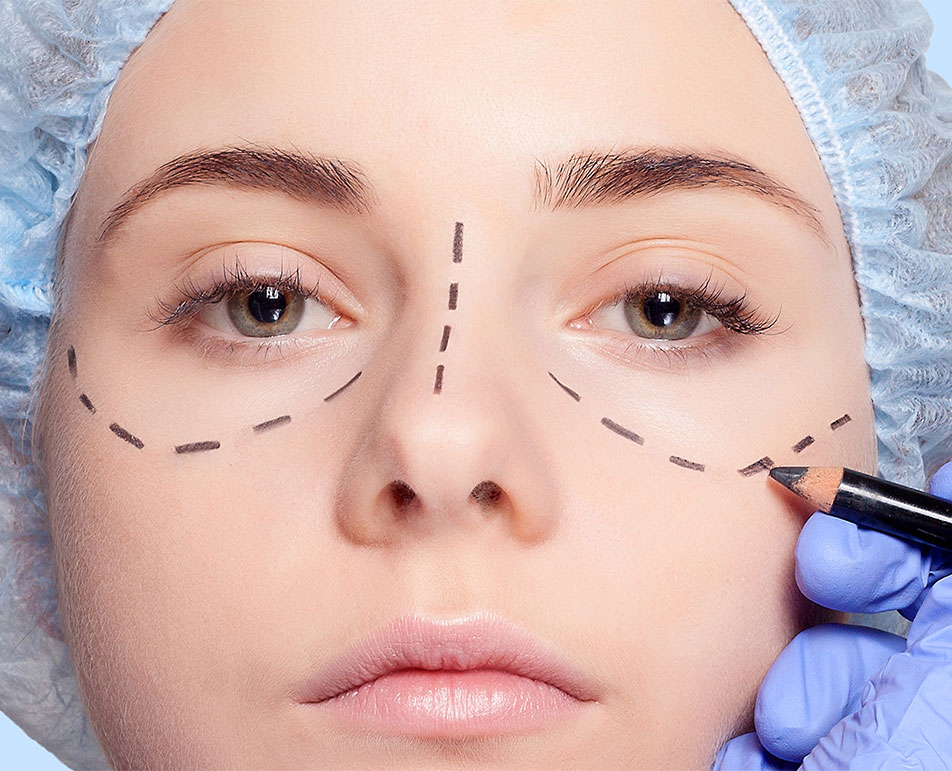 Blepharoplasty Consultation
