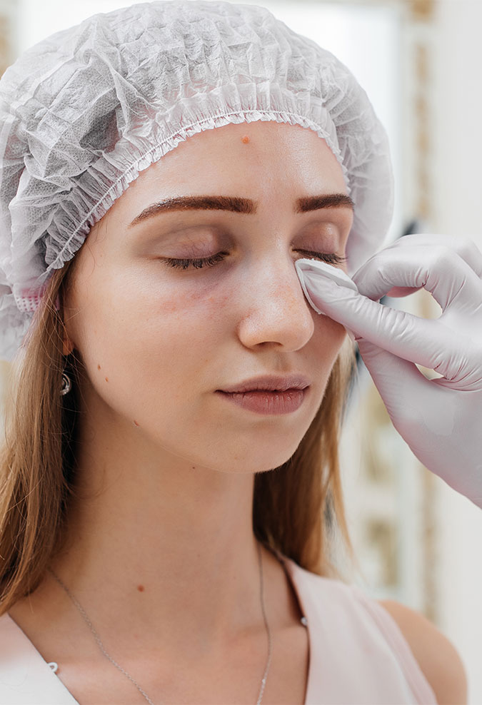 Blepharoplasty Consultation